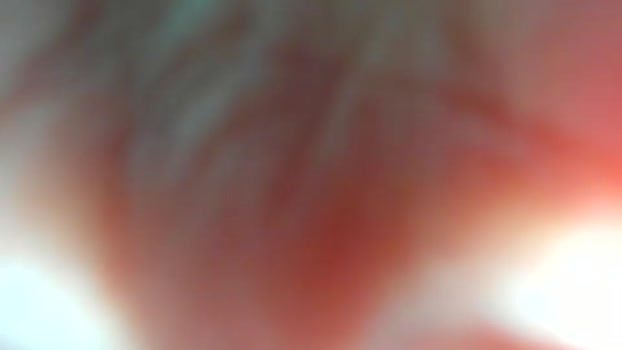 kobayaske 05-01-2025 video beautiful