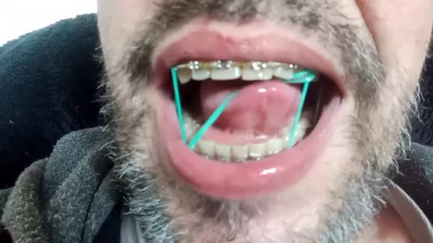 lexcerdex 15-04-2025 video twink